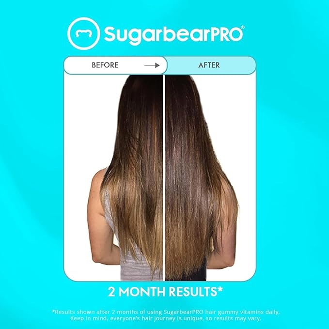 Sugarbear Hair Vitamin Gummy 6 Month Supply Extra Strength Biotin 6000mcg + Glass Nail File -Growth for Men & Women, Vegan Vitamin B12, MSM, Inositol, Elderberry, Certified Kosher, Halal, Cruelty-Free