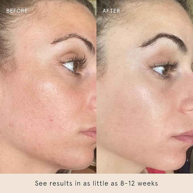 Barefaced Liquid Gold 30ml - 15% Vitamin C Serum with Hyaluronic Acid & Vitamin E for Brightening, Anti-Aging, and Hydration, Antioxidant Formula, Reduce Dark Spots, Acne & Wrinkles