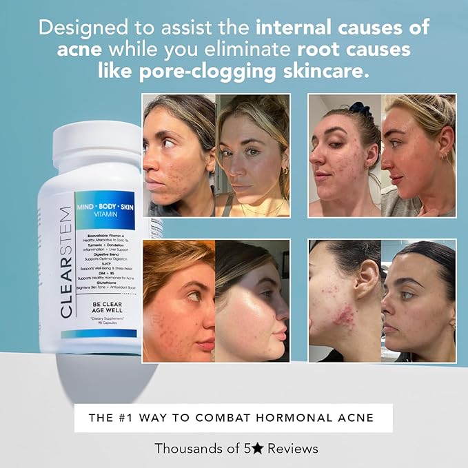 CLEARSTEM - MINDBODYSKIN Hormonal Acne Supplement (5-HTP) - Natural DIM Supplement - Skin Care Vitamins - Hormone Balance, Antioxidants - Vegan, Gluten Free, Cruelty Free - 30 Servings, 90 Capsules