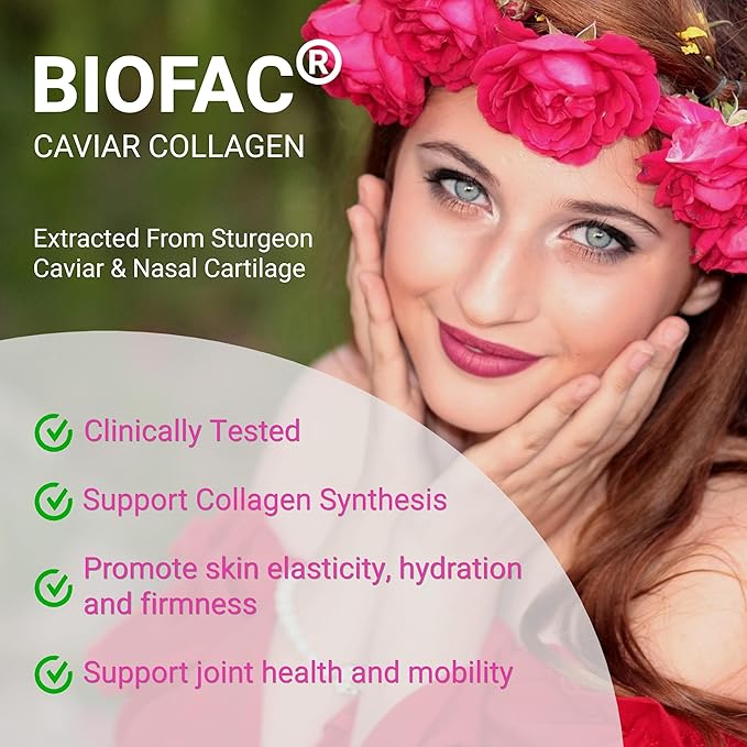 UpNourish Prebiotics, Probiotics and Caviar Colalgen for Women's Digestive & Weight Wellness, Skin Radiance, Joint Mobility, Feminine Health with Cranberry Extract & D-Mannose, 30 Fast-melt Packets